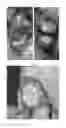 Fig. 03 - Meniscus for joint reconstruction