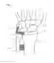 Fig. 02 - Distal radioulnar joint prosthesis and method of use