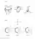 Fig. 07 - Distal radioulnar joint prosthesis and method of use