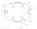 Fig. 05 - Artificial cervical and lumbar discs, disc plate insertion gun for performing sequential single plate intervertebral implantation enabling symmetric bi-disc plate alignment for interplate mobile core placement