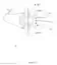 Fig. 14 - Artificial cervical and lumbar discs, disc plate insertion gun for performing sequential single plate intervertebral implantation enabling symmetric bi-disc plate alignment for interplate mobile core placement