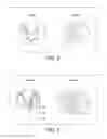 Fig. 03 - Spinal Cord Devices and Methods for Promoting Axonal Regeneration