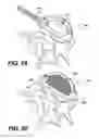 Fig. 11 - Vertebral implants and related methods of use
