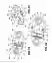 Fig. 13 - Vertebral implants and related methods of use