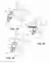 Fig. 15 - Vertebral implants and related methods of use