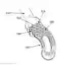 Fig. 01 - Self-pivoting spinal implant and associated instrumentation