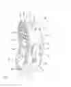 Fig. 03 - Self-pivoting spinal implant and associated instrumentation