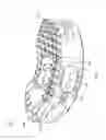 Fig. 07 - Self-pivoting spinal implant and associated instrumentation