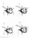 Fig. 13 - Self-pivoting spinal implant and associated instrumentation