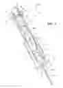 Fig. 06 - Instrument configured to generate an impact and retracting load on an inserter