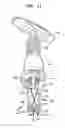 Fig. 12 - Intervertebral implant with integrated fixation