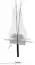 Fig. 02 - Arthroplasty apparatus and method