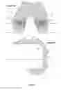 Fig. 04 - Arthroplasty apparatus and method