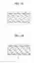 Fig. 04 - Hybrid stent