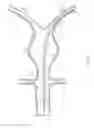 Fig. 03 - Balloon assisted endoluminal prosthesis deployment