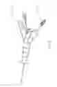 Fig. 13 - Balloon assisted endoluminal prosthesis deployment