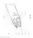 Fig. 15 - Balloon assisted endoluminal prosthesis deployment