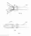 Fig. 11 - Stent graft with a longitudinal support member
