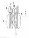 Fig. 12 - Stent graft with a longitudinal support member