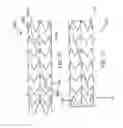Fig. 26 - Stent graft with a longitudinal support member