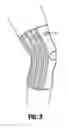 Fig. 03 - Transformable orthopedic brace for injury prevention