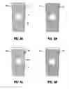 Fig. 04 - Transformable orthopedic brace for injury prevention