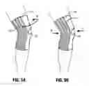 Fig. 05 - Transformable orthopedic brace for injury prevention