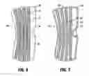 Fig. 06 - Transformable orthopedic brace for injury prevention