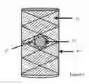 Fig. 02 - Apparatus and method for treating eye diseases