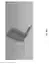 Fig. 110 - Negative pressure wound closure device