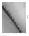 Fig. 16 - Negative pressure wound closure device