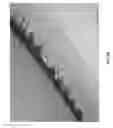 Fig. 17 - Negative pressure wound closure device