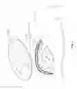 Fig. 20 - Negative pressure wound closure device
