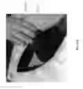 Fig. 24 - Negative pressure wound closure device