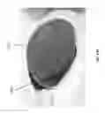 Fig. 27 - Negative pressure wound closure device