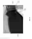 Fig. 28 - Negative pressure wound closure device