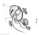Fig. 34 - Negative pressure wound closure device