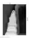 Fig. 50 - Negative pressure wound closure device