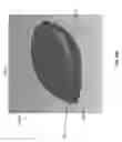 Fig. 55 - Negative pressure wound closure device