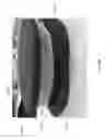 Fig. 60 - Negative pressure wound closure device