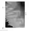 Fig. 61 - Negative pressure wound closure device