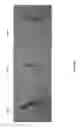 Fig. 72 - Negative pressure wound closure device