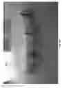 Fig. 76 - Negative pressure wound closure device