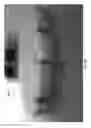 Fig. 77 - Negative pressure wound closure device