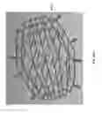 Fig. 79 - Negative pressure wound closure device