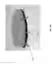 Fig. 95 - Negative pressure wound closure device