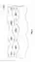 Fig. 09 - Negative pressure wound therapy apparatus and methods