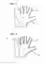 Fig. 03 - Glove and Sock Burn Dressing with Variable Pore Sizes