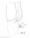Fig. 09 - ANUS CREVICE INSERT