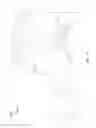 Fig. 11 - Tilt-tip moldable total care bed